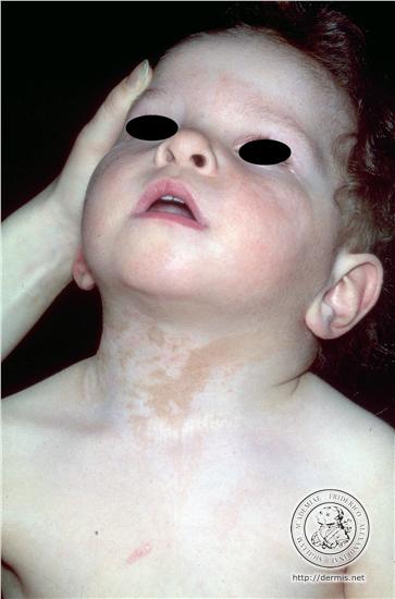 birthmarks1.jpg