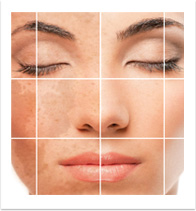 pigmentation1
